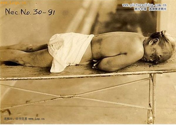 731部队残忍的活人实验