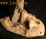 ����Ѫ������ʬ